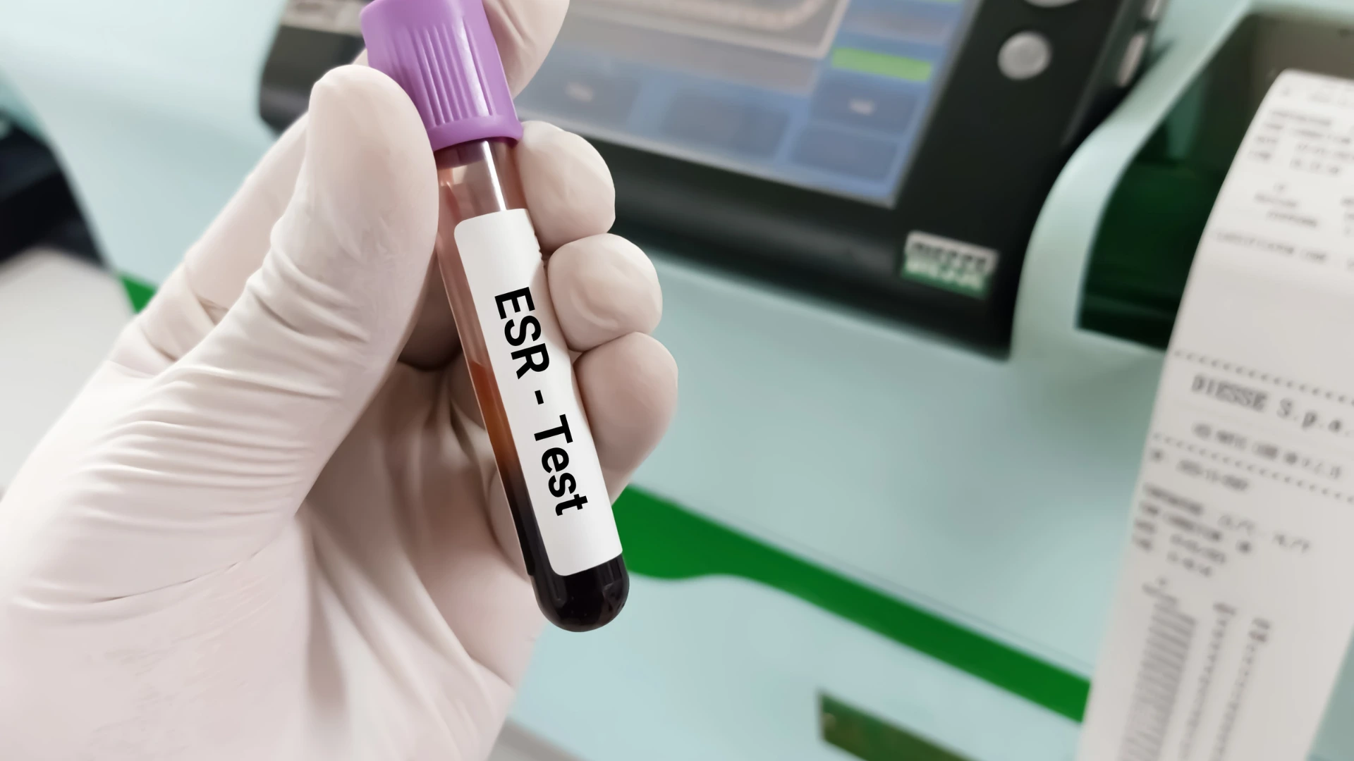 ESR Test